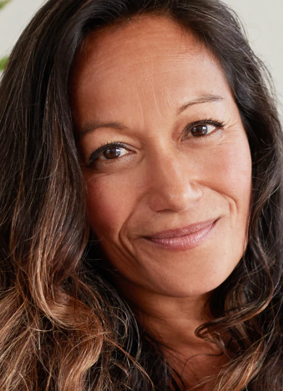 Botox treatment at Layna Young Med Spa